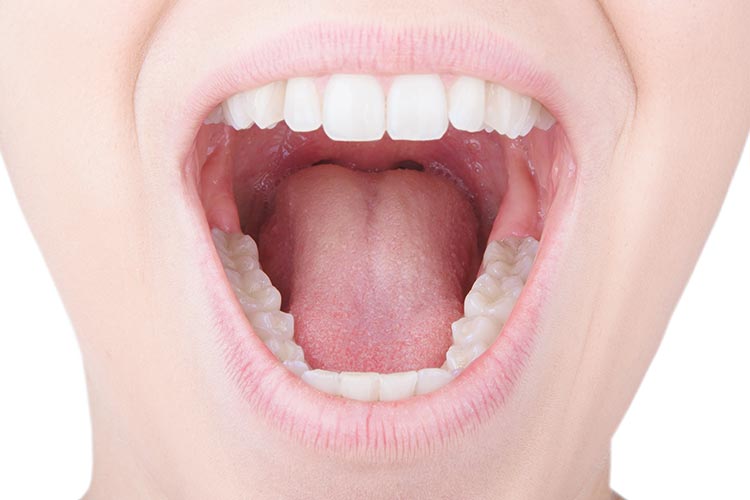 舌下免疫療法のイメージ写真