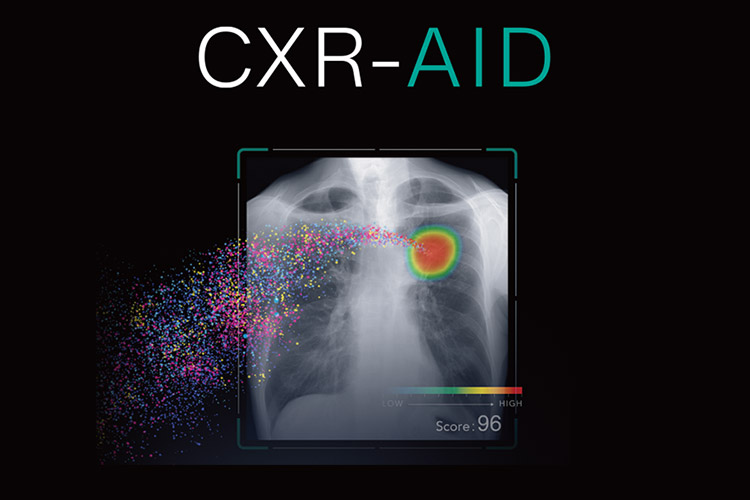 CXR-AID（胸部レントゲン画像病変検出AI）